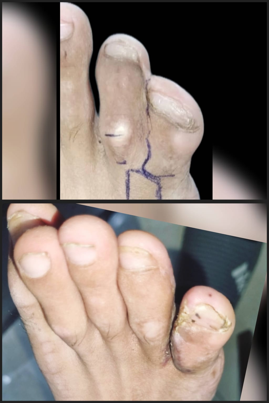 Before & After 63